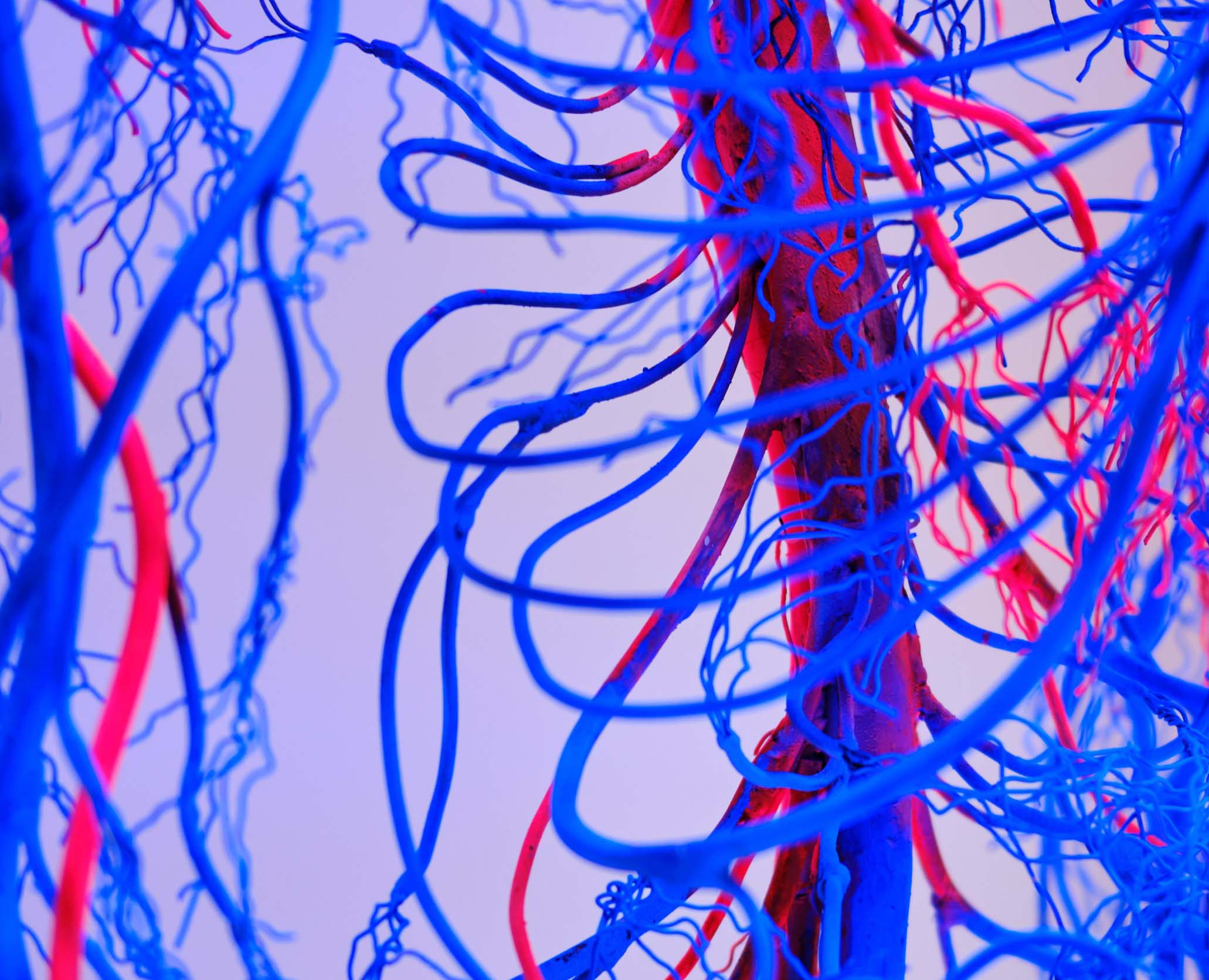 Angiograms