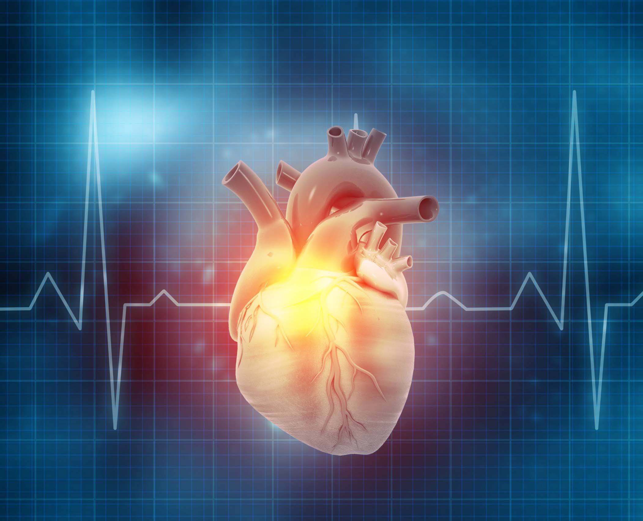 CABG (Heart Bypass)