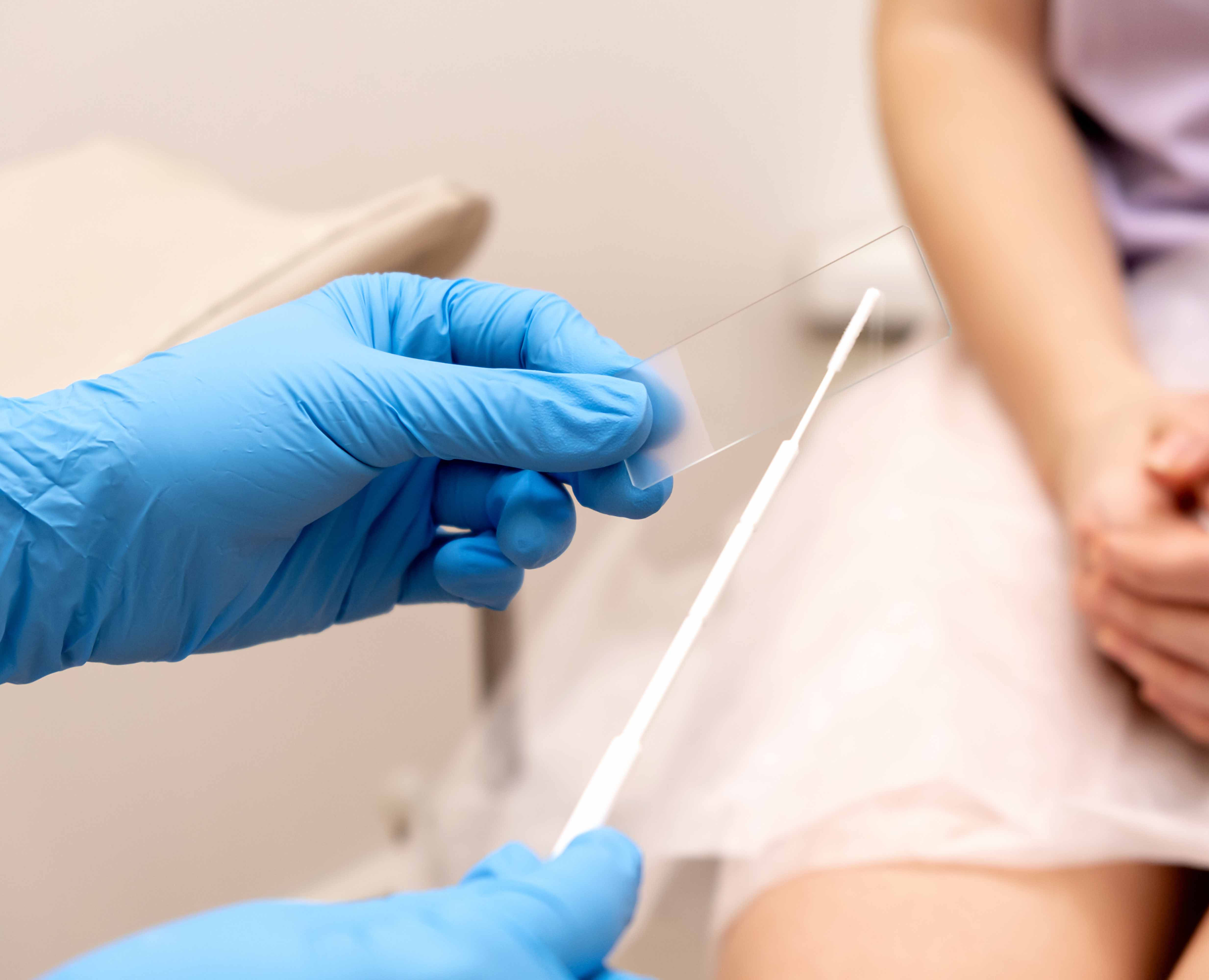 Pap Smear