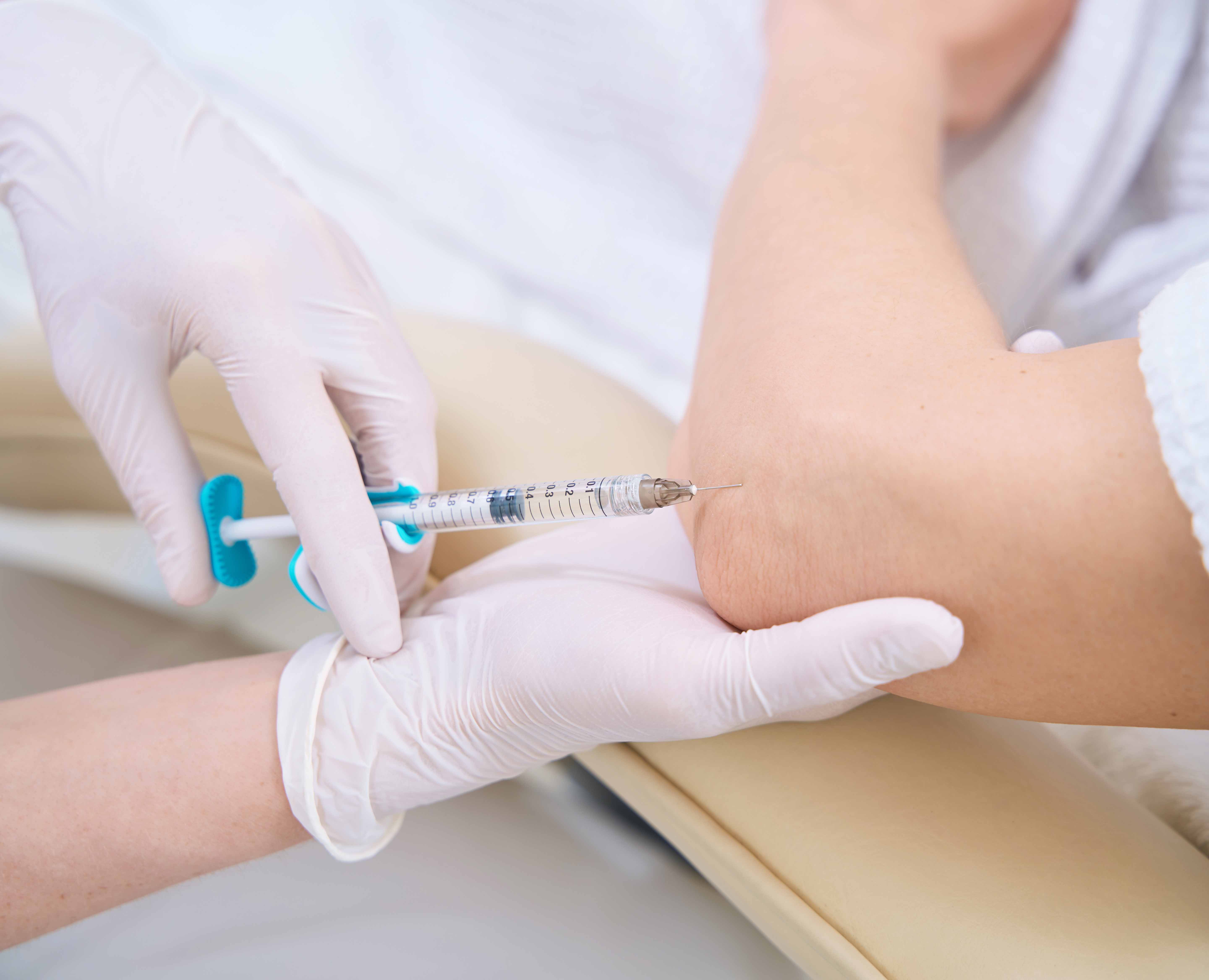 Intraarticular Injections