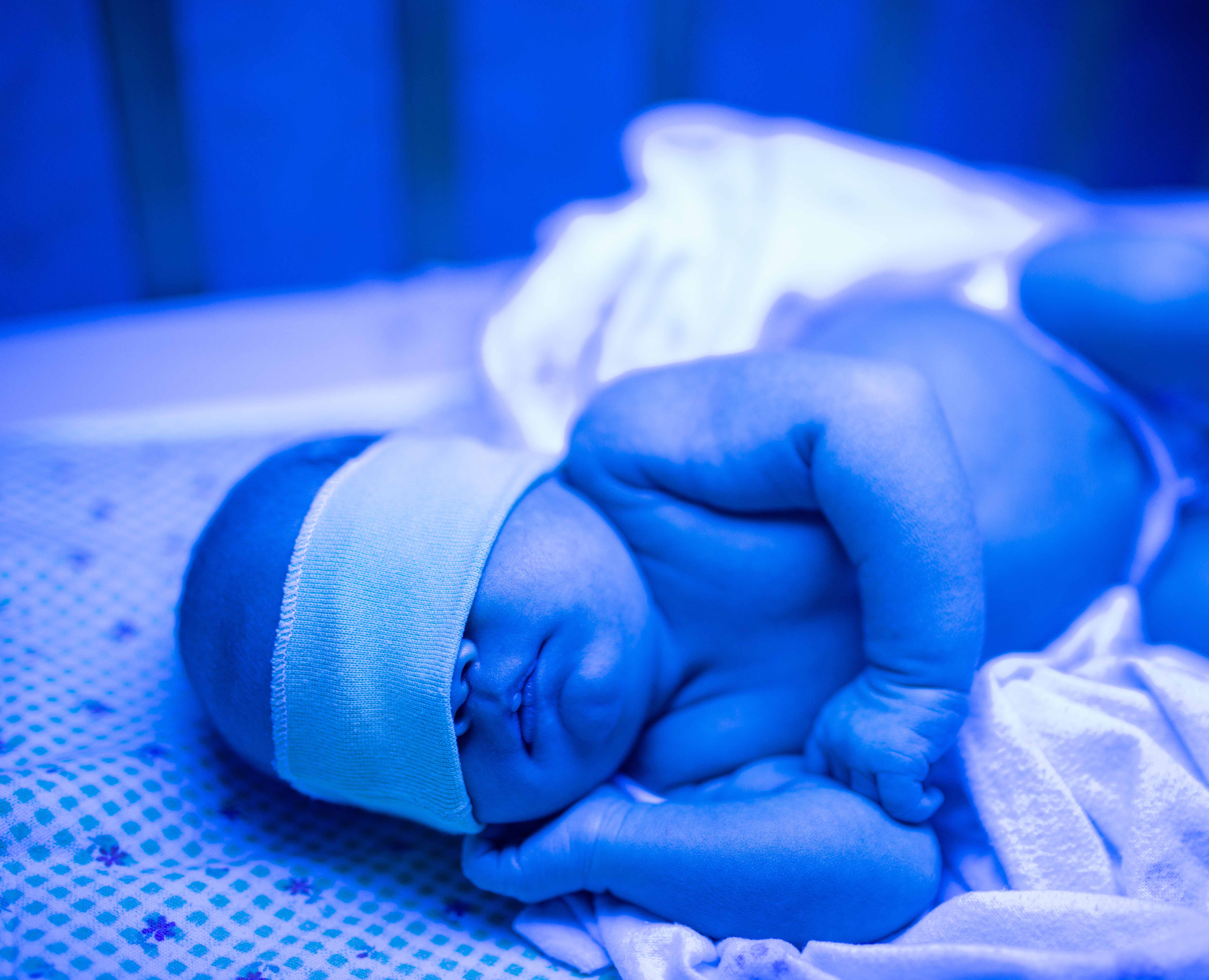 Neonates