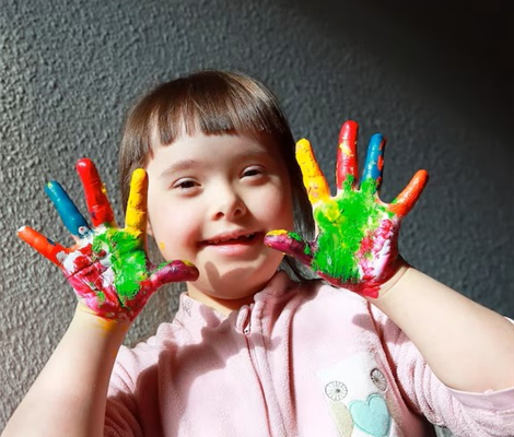 What is Down Syndrome?