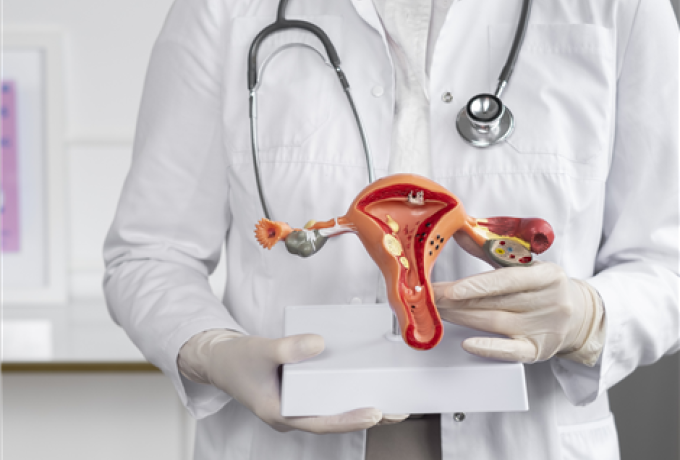 Cervical Cancer